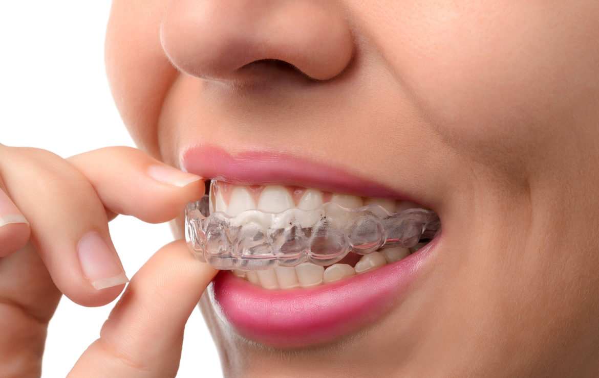 Ortodontik Tedavi Nedir?